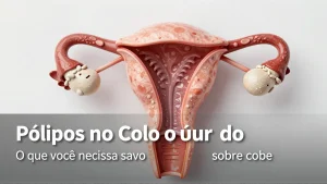 Pólipos no Colo do Útero: O que você precisa saber sobre causas e prevenção